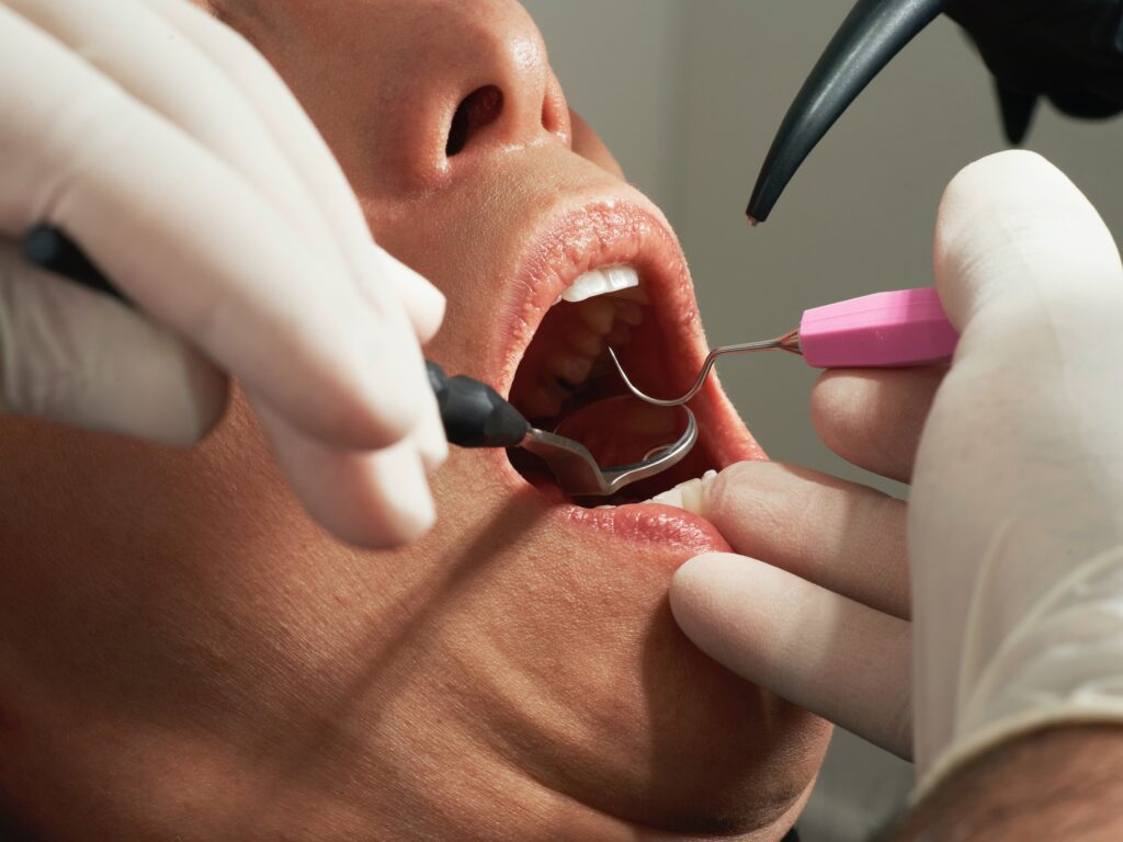植牙手術人人都可以做嗎？術前必知植牙風險五大重點—林楚喬牙醫