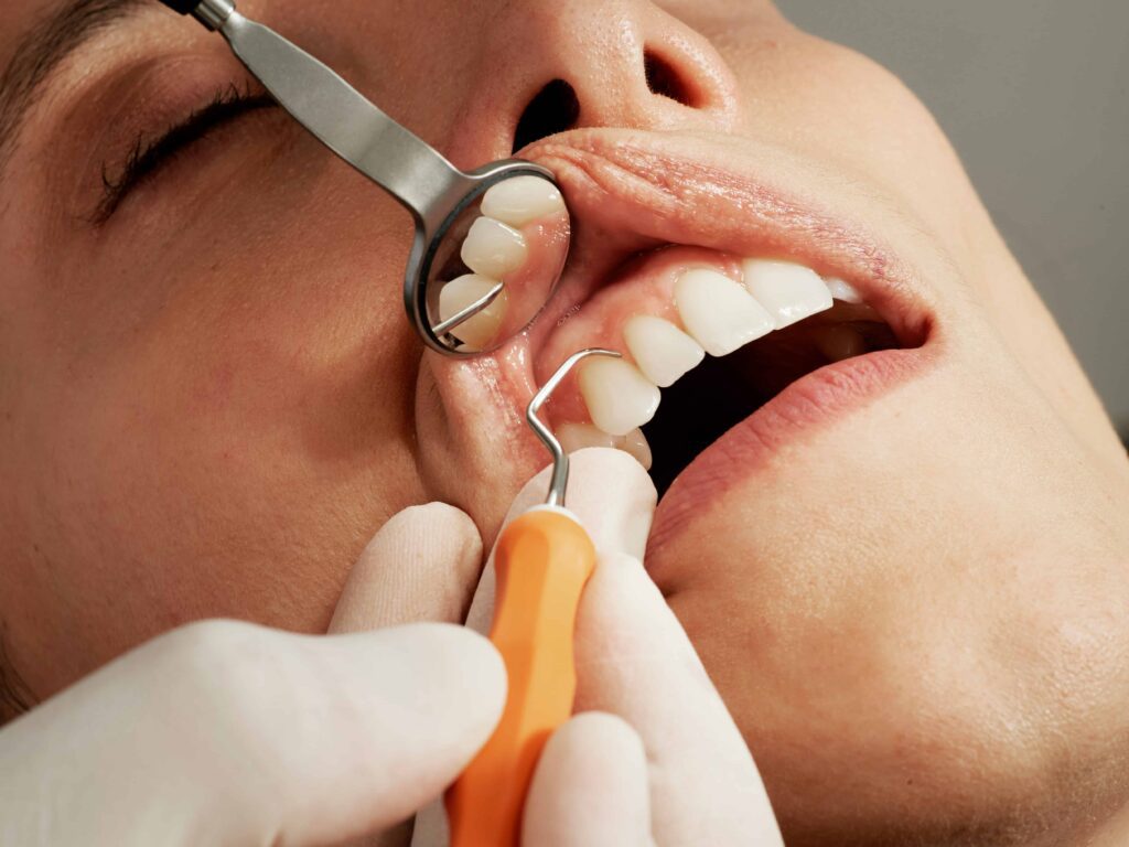 認識人工植牙：我適合植牙嗎？什麼情況應該要植牙、植牙注意事項- 林楚喬醫師